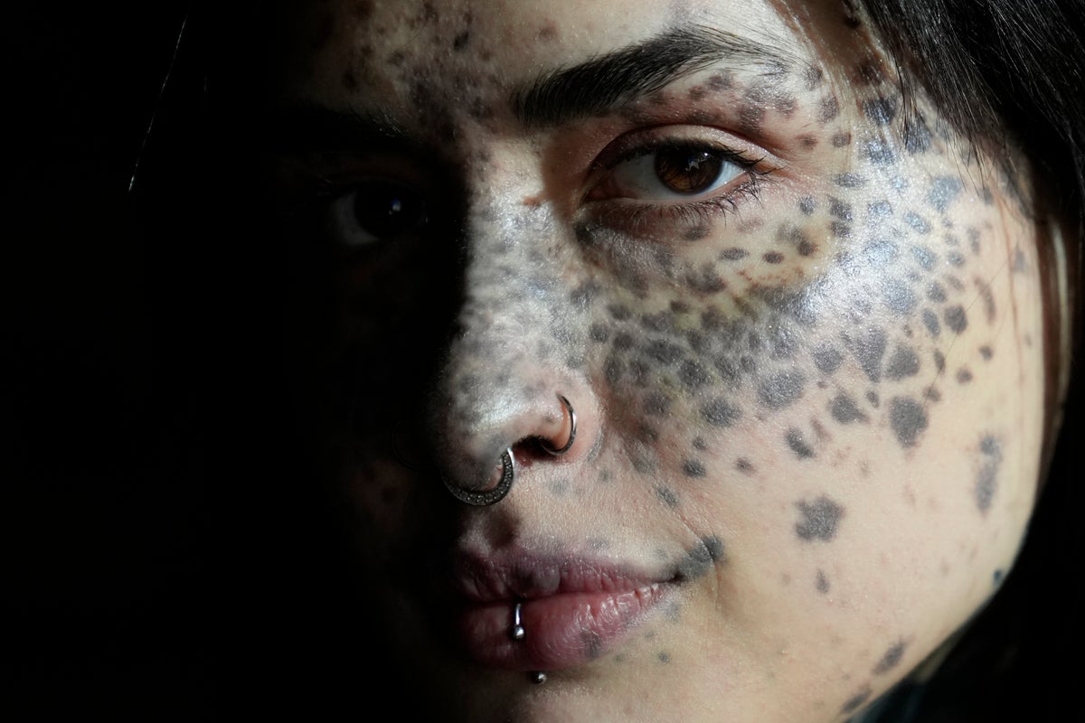 AP Foto: le modelle ‘imperfette’ ridefiniscono la bellezza in Italia