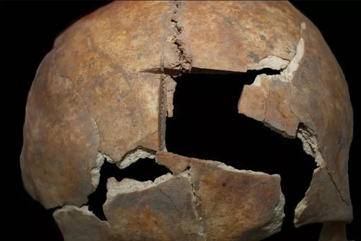 Bronze Age grave in Israel reveals man had brain surgery 3,000 years ...