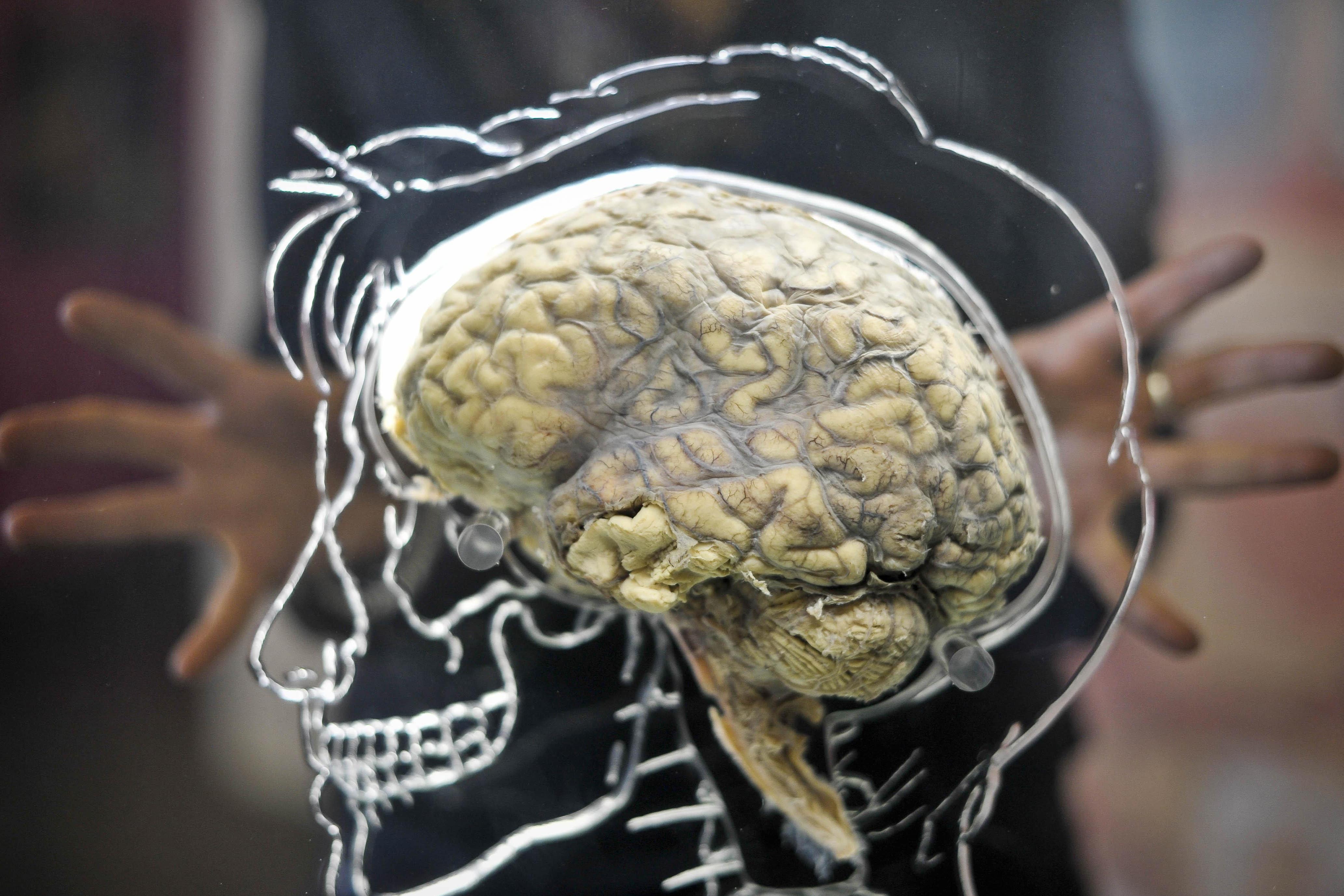 Researchers said it is important to note that the risk of developing a brain cancer is overall low so, even after an injury, the risk remains modest (Ben Birchall/PA)