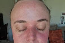 Woman’s rare condition caused her eyes to ‘switch off’ while driving