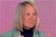 Loose Women’s Carol McGiffin addresses concern after face resembles ‘tomato’