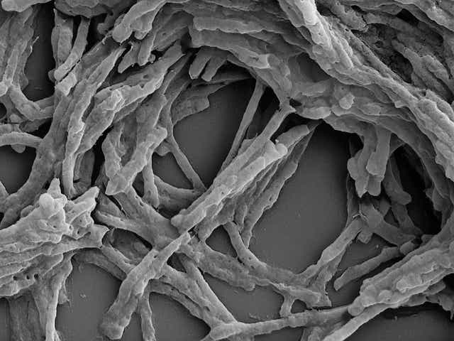 La enzima Huc capaz de convertir el aire en electricidad es utilizada por la bacteria mycobacterium smegmatis