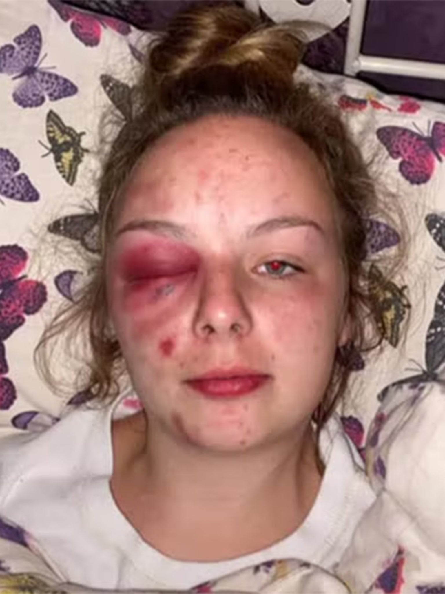 Eleanor Williams post pictures on social media of injuries she inflicted on herself
