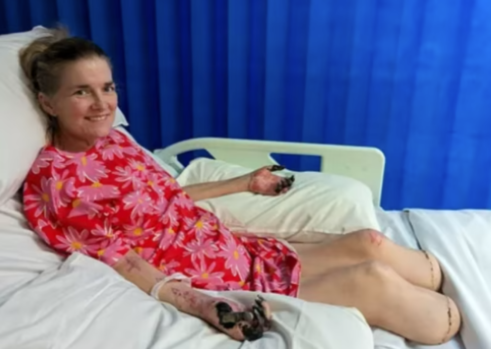 Julianna lost both her legs to sepsis