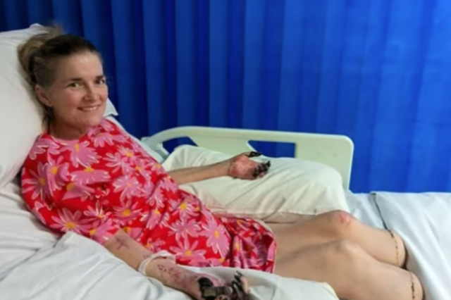 <p>Julianna lost both her legs to sepsis</p>