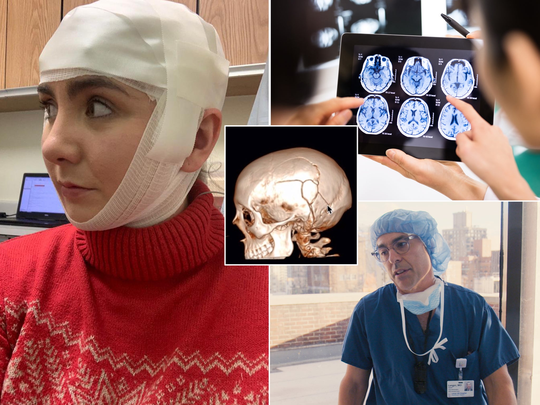 Lucy Gray at hospital (left), Lucy’s skull scan (centre), Dr David Langer, chair of neurosurgery at Lenox Hill hospital (bottom right), stock brain scan (top right)