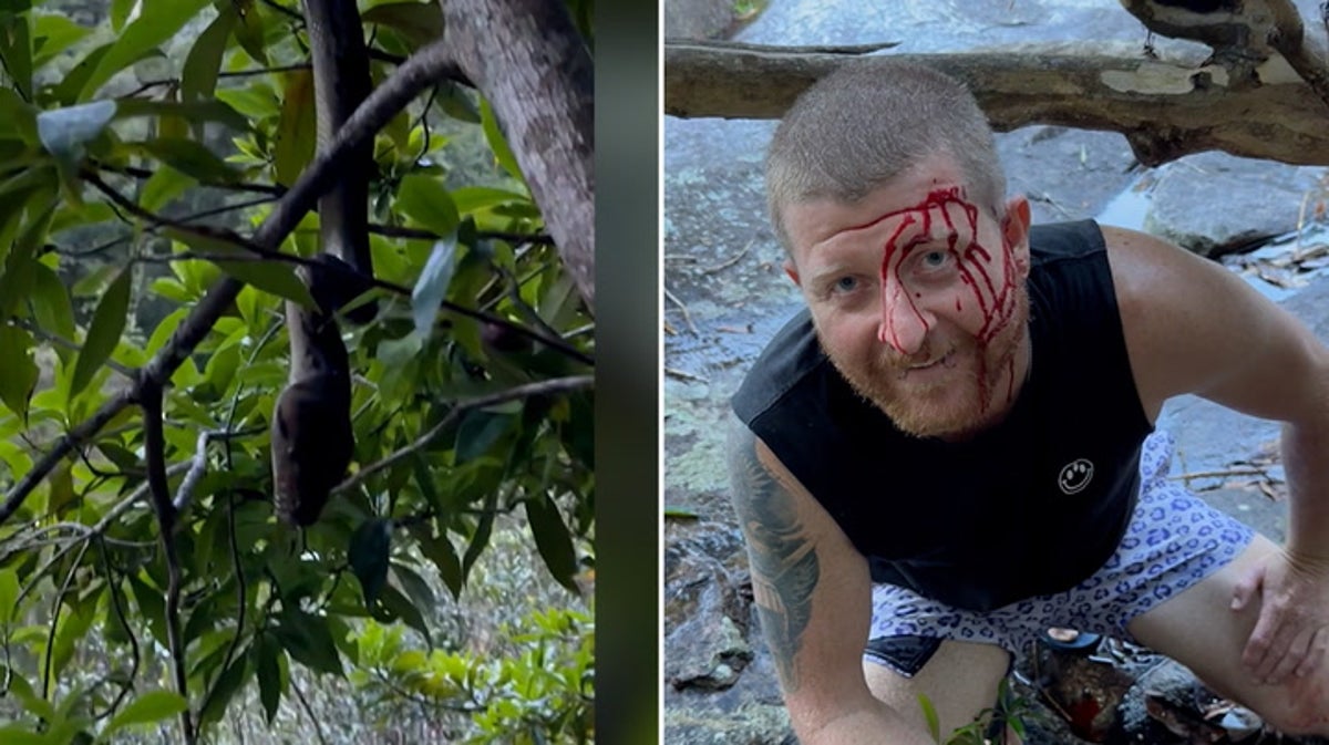 Python leaves Australian hiker bloodied after ‘slapping’ his face