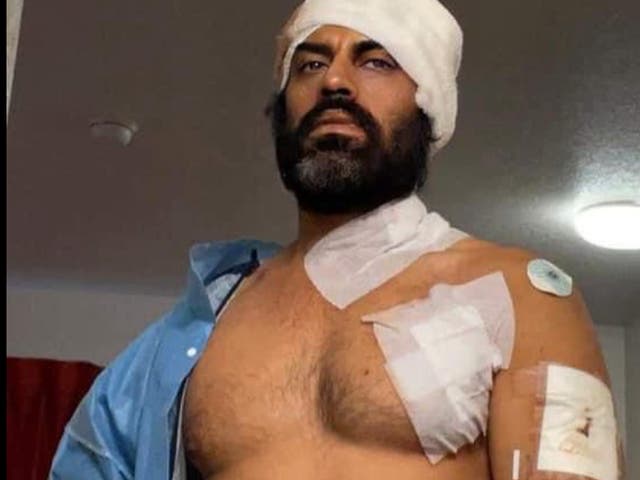 <p>Aman Dhaliwal, a Bollywood actor, shows off his wounds after a man attacked him with a knife and a hatchet outside a Planet Fitness in Corona, California</p>