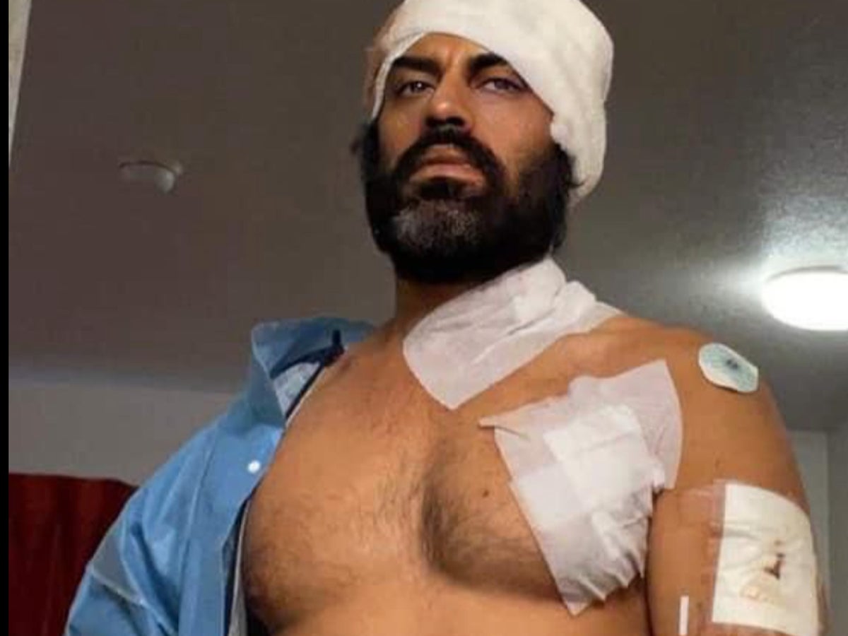 Bollywood actor reveals horror injuries after being attacked by a hatchet in California gym