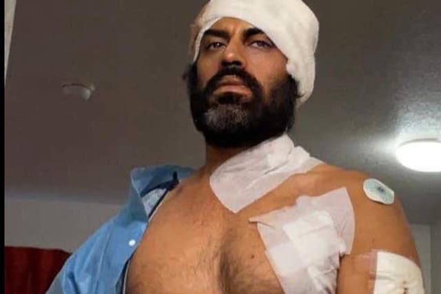 <p>Aman Dhaliwal, a Bollywood actor, shows off his wounds after a man attacked him with a knife and a hatchet outside a Planet Fitness in Corona, California</p>