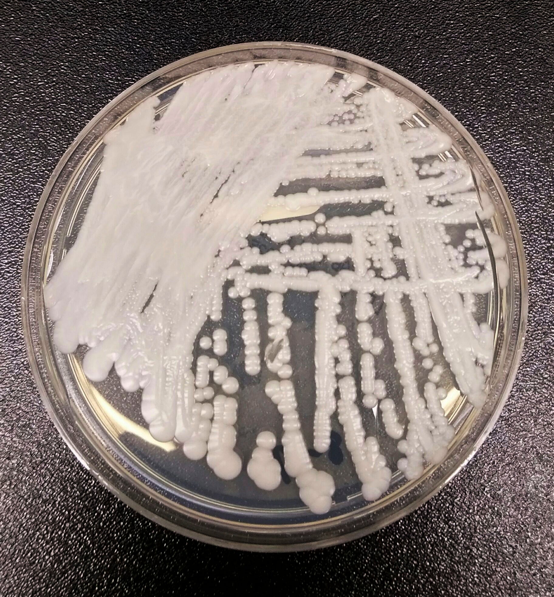 <p>EEUU HONGO SUPERBACTERIA</p>
