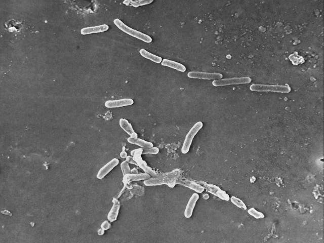 <p>This scanning electron microscope image made available by the Centers for Disease Control and Prevention shows rod-shaped Pseudomonas aeruginosa bacteria. </p>