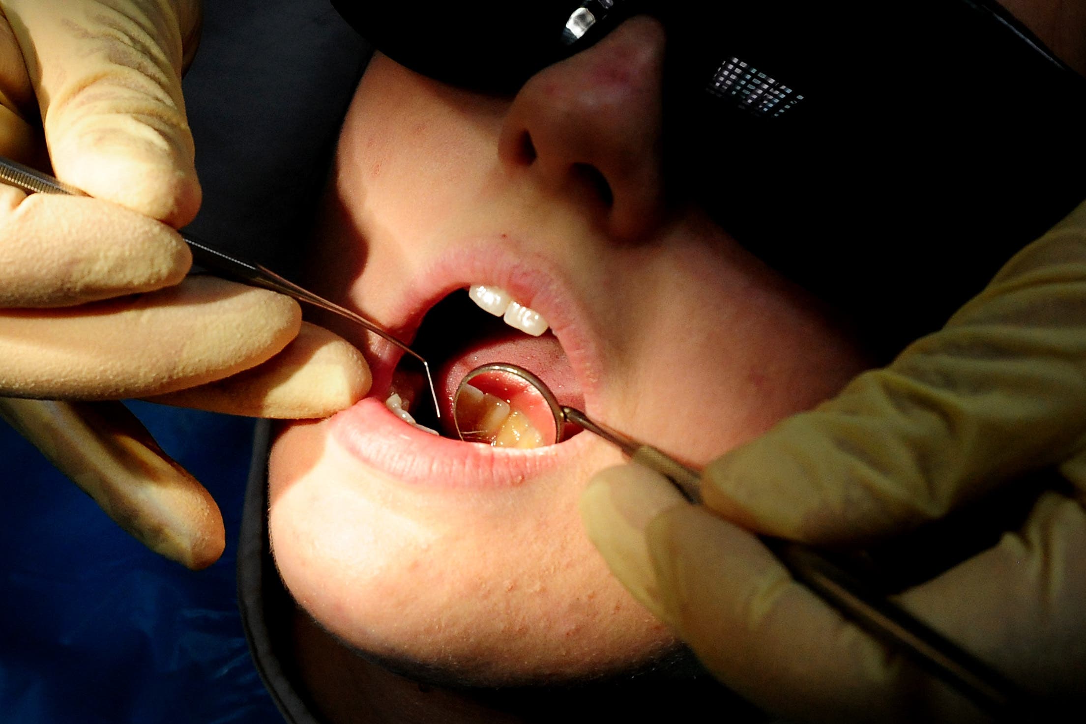 A new poll suggests people are going without dental care (Rui Vieira/PA)