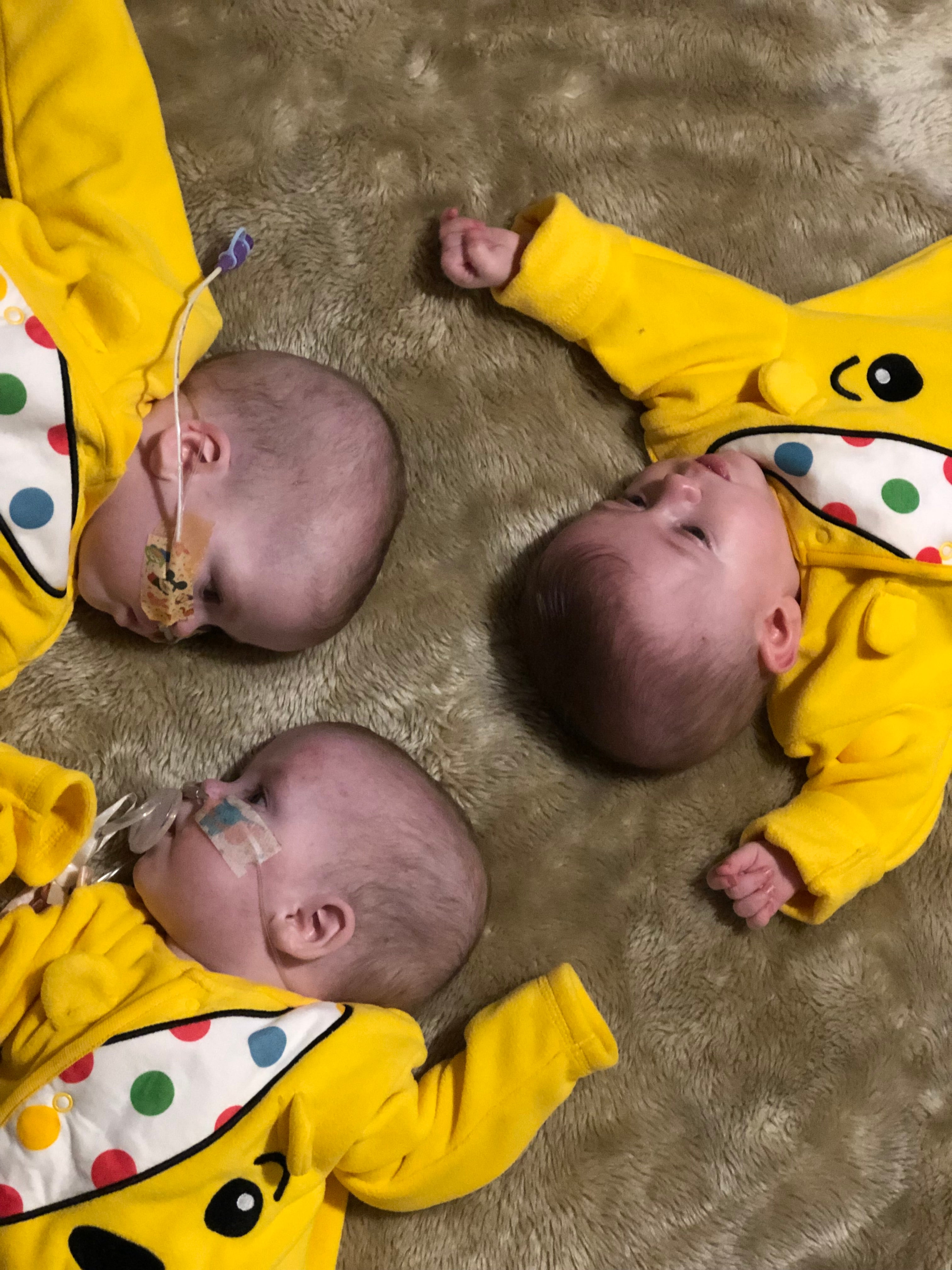 The triplets have set two world records for the most premature birth and lightest ever birth-weight