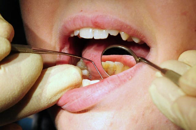 Bupa Dental Care is set to cut 85 dental practices in a move that will impact 1,200 staff across the UK, amidst a national shortage of dentists and “systemic” challenges across the industry (Rui Vieira/PA)