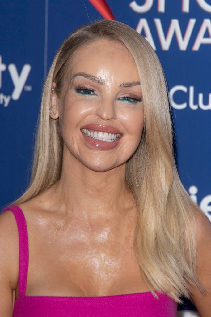 The ‘Corrie’ team worked with Katie Piper’s foundation while researching the storyline – the TV presenter survived an acid attack in 2008