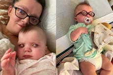 Mother documents story of baby born with bubble on eyeball from glaucoma as she says infant is ‘thriving’