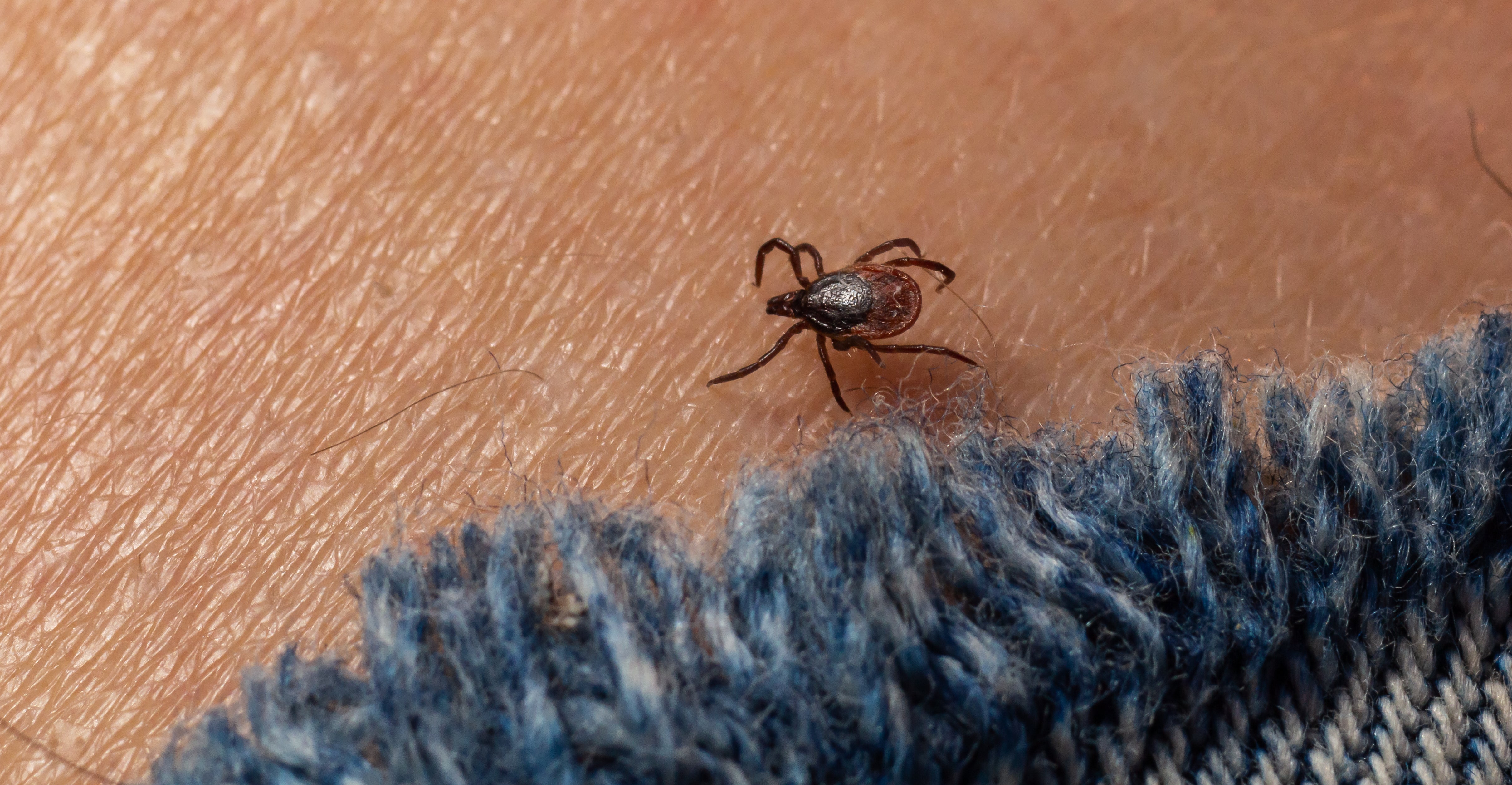 Tick-borne encephalitis is “likely” to be present in the UK, health officials have said