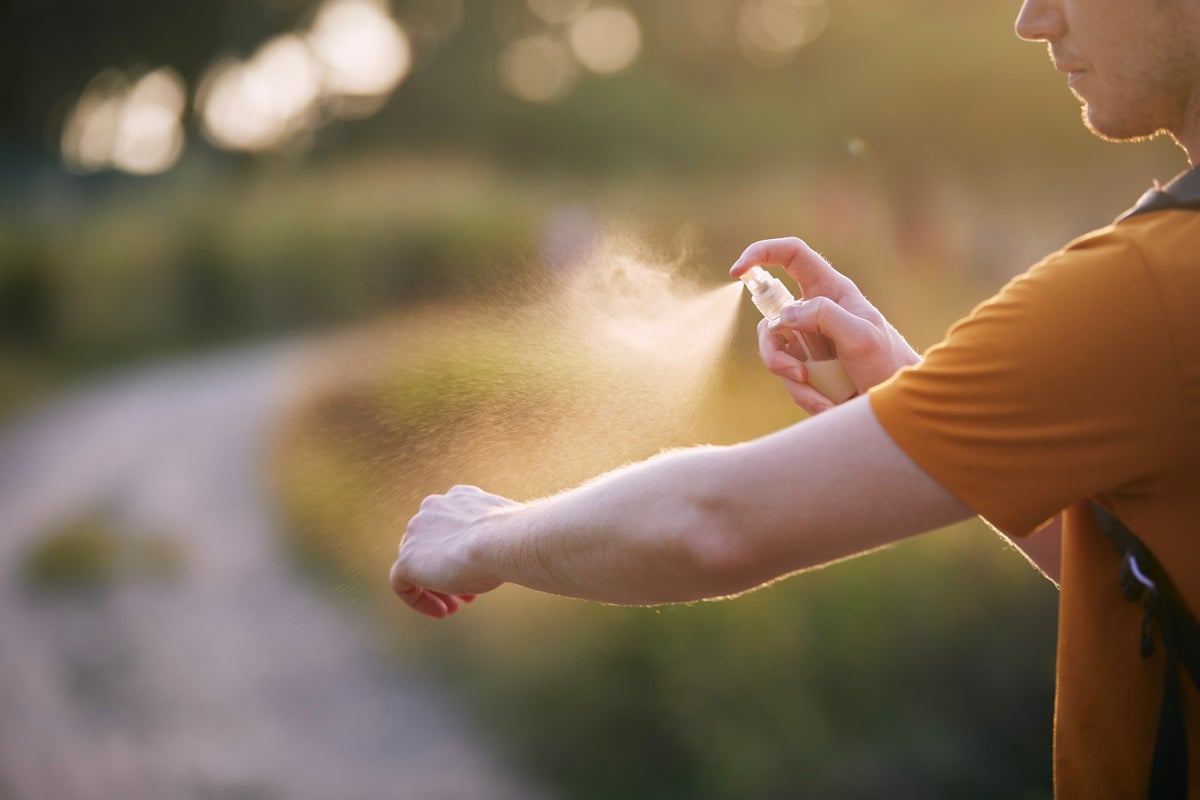 From wasps to jellyfish: How to treat stings and bites this summer