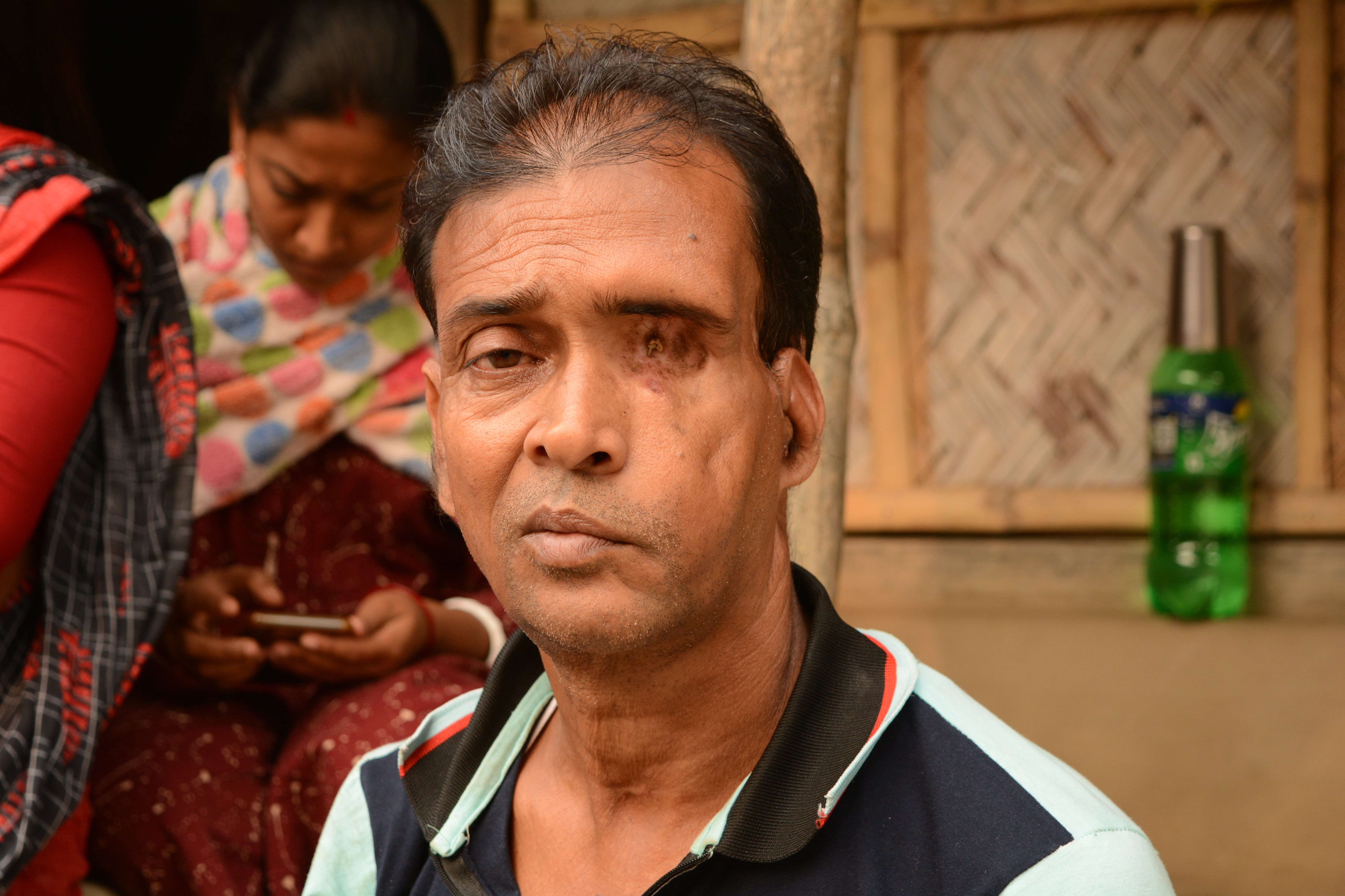 Mihir Sardar, 52, survived a tiger attack in the Sundarbans