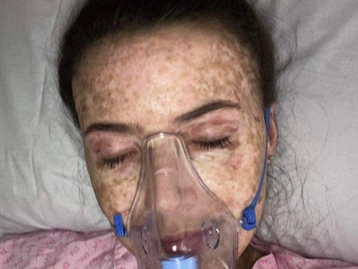 Kanker darah: Wanita dengan tepat mendiagnosis gejala leukemia meskipun dokter bersikeras bahwa itu adalah radang amandel