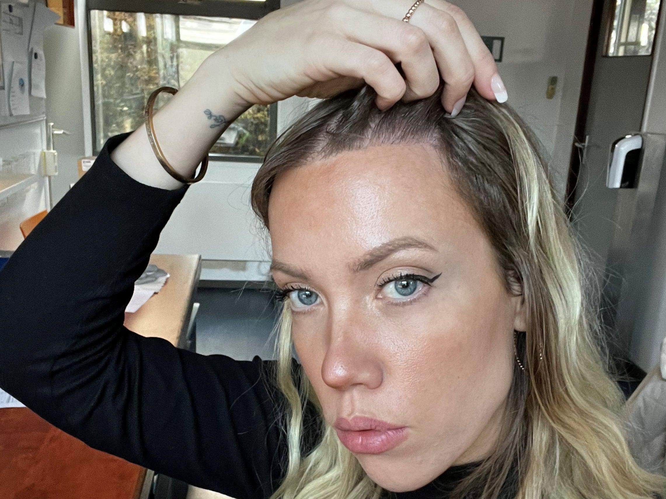 Big Forehead