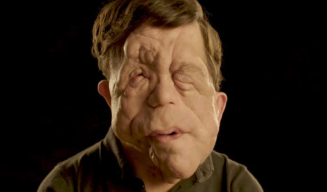 <p>Actor and presenter Adam Pearson, who is a Changing Faces ambassador, has urged police forces to “do more” as the number of people with visible differences or disfigurements who say they were the victim of a hate crime has increased since 2019</p>