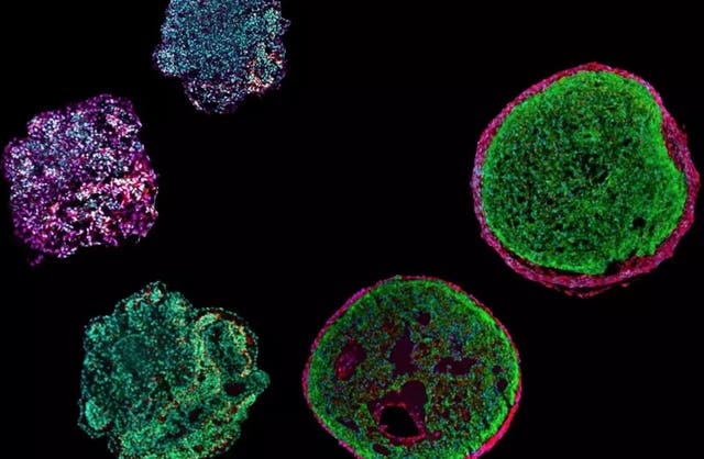<p>These “epicardioids” - organoids made from pluriopotent stem cells - are just 0.5 millimeters in size. Researchers can use them to mimic the development of the human heart in the laboratory and study hereditary heart diseases</p>