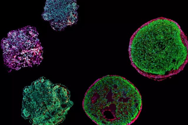 <p>These “epicardioids” - organoids made from pluriopotent stem cells - are just 0.5 millimeters in size. Researchers can use them to mimic the development of the human heart in the laboratory and study hereditary heart diseases</p>