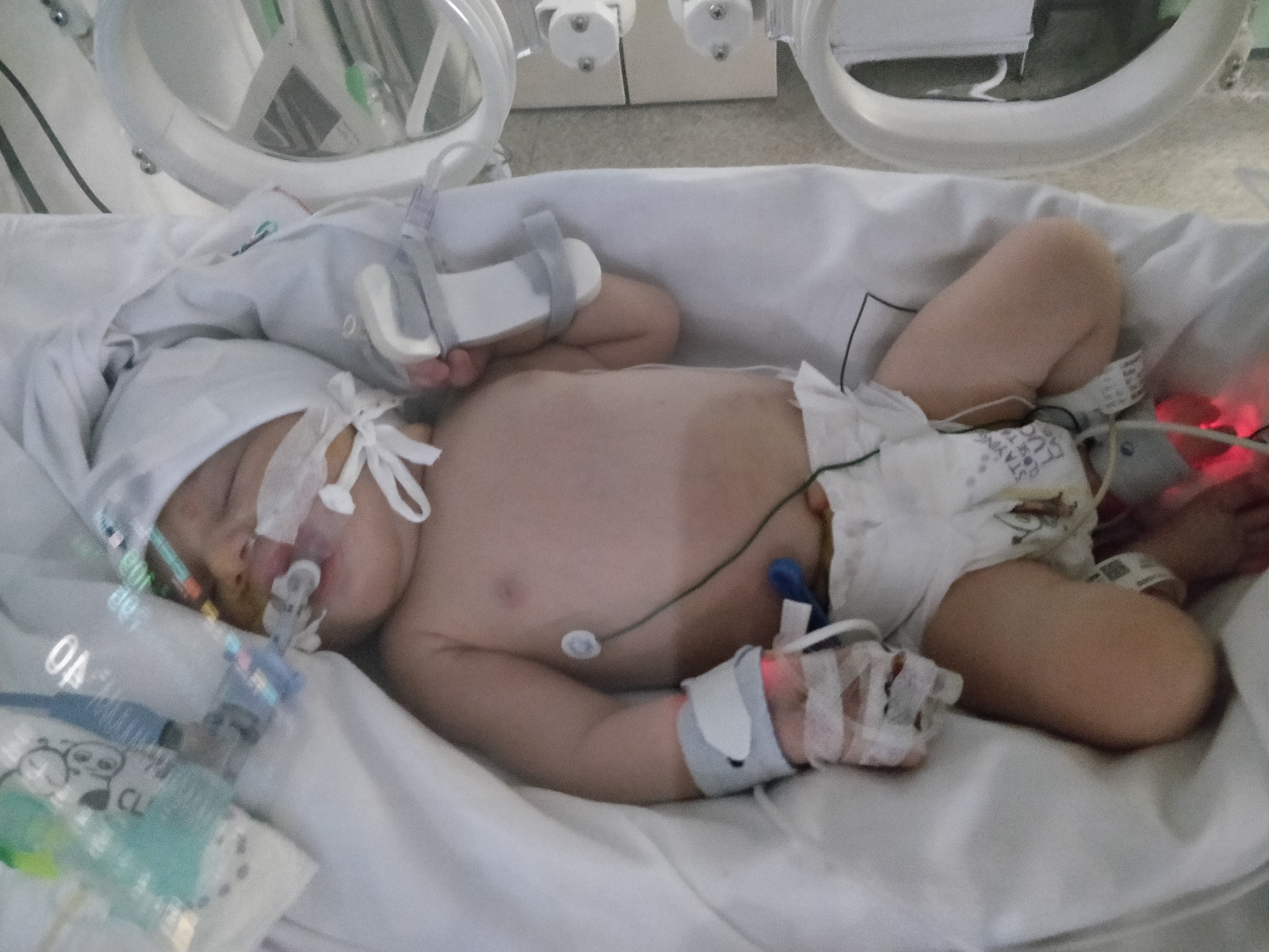 Fey Ijaware’s son Eric in the NICU