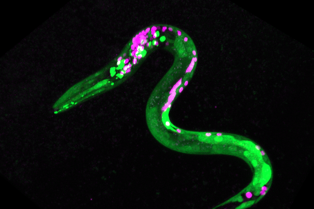 The fluorescent green dots in this nematode worm reveal neurons that respond to cannabinoids (Stacy Levichev/University of Oregon/PA)
