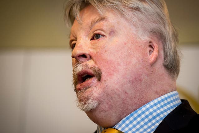 <p>Simon Weston says refusing pilot refuge in the UK sends the wrong message to the world </p>