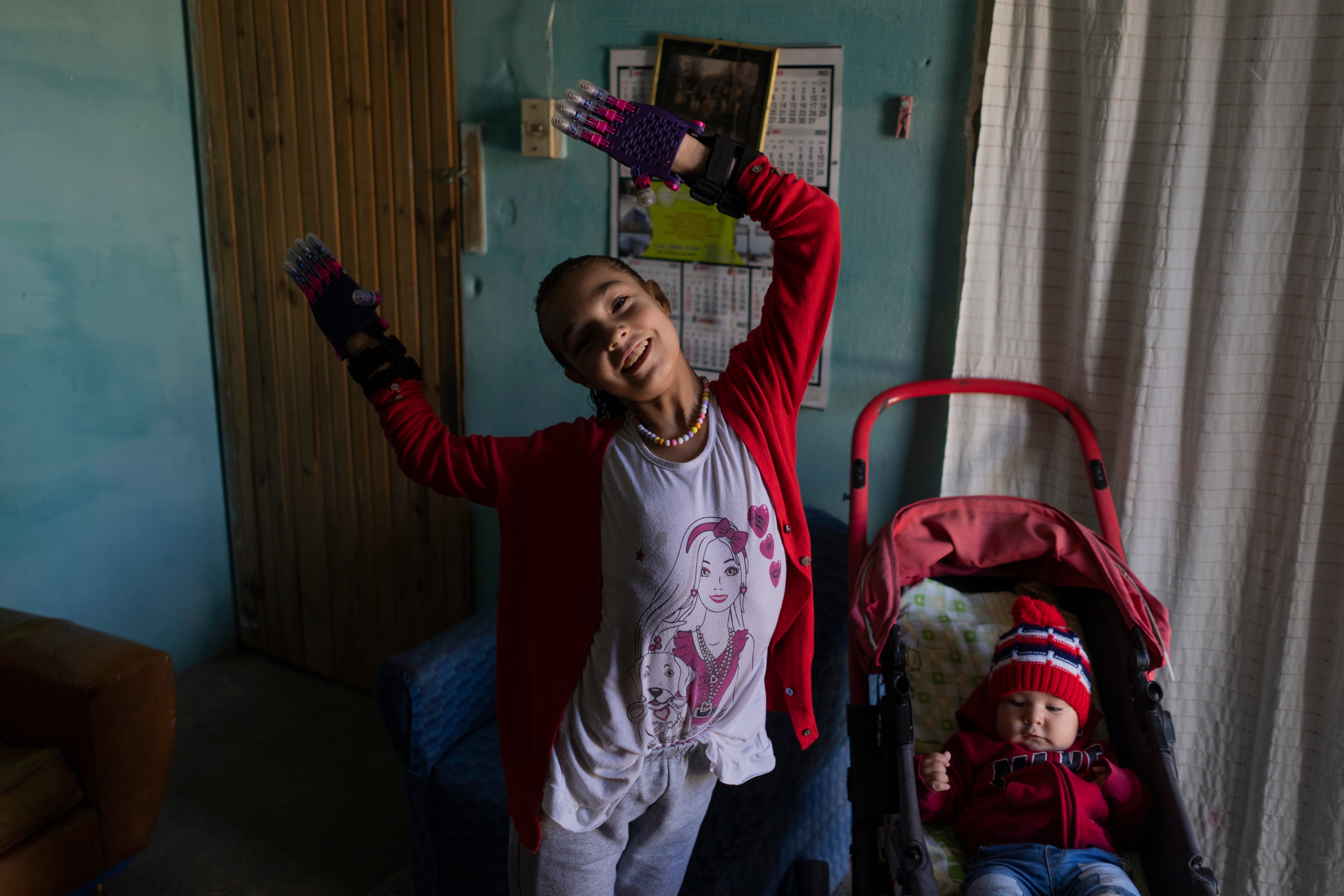 Uruguay 3D Prosthetics