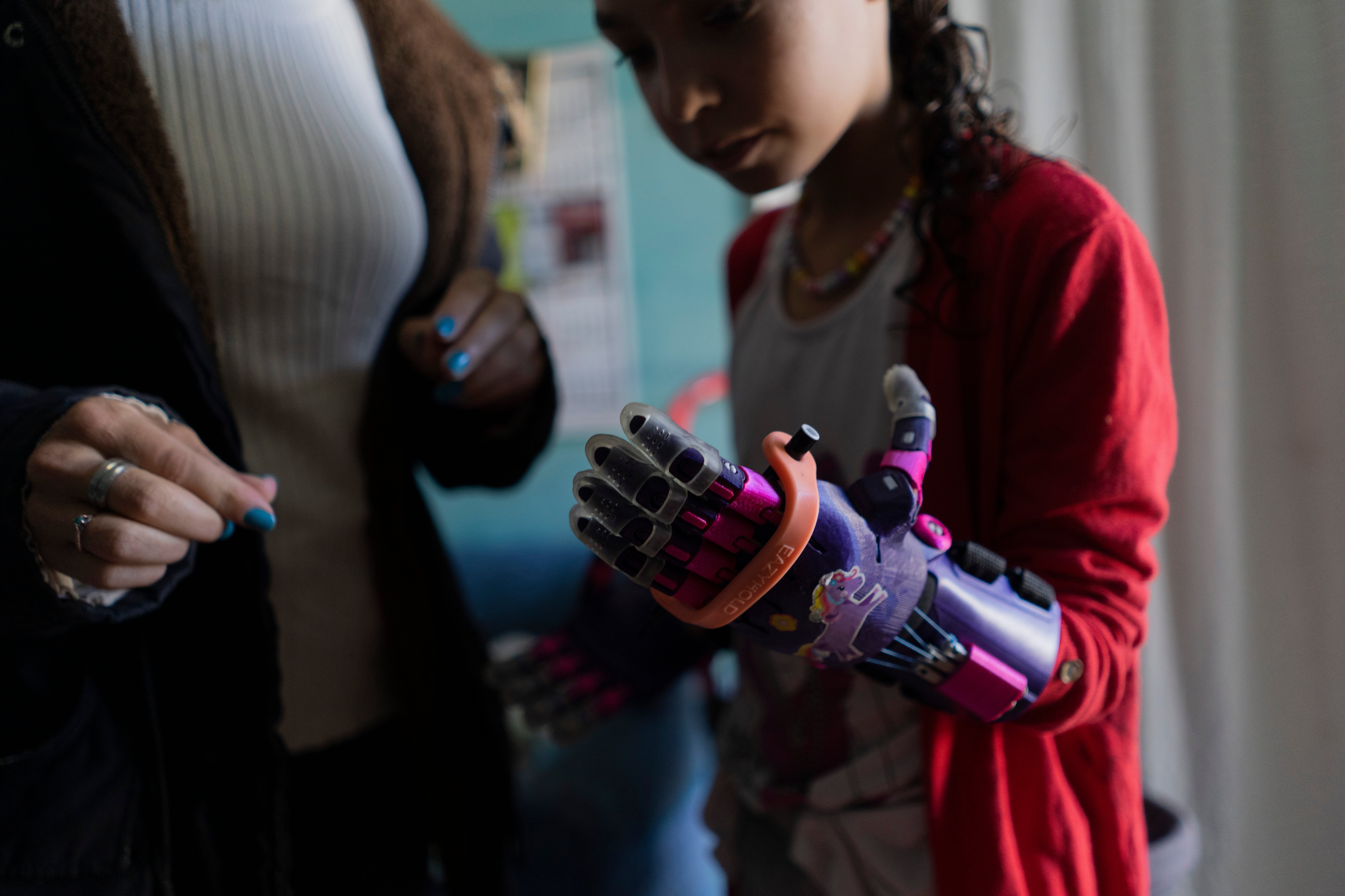 Uruguay 3D Prosthetics