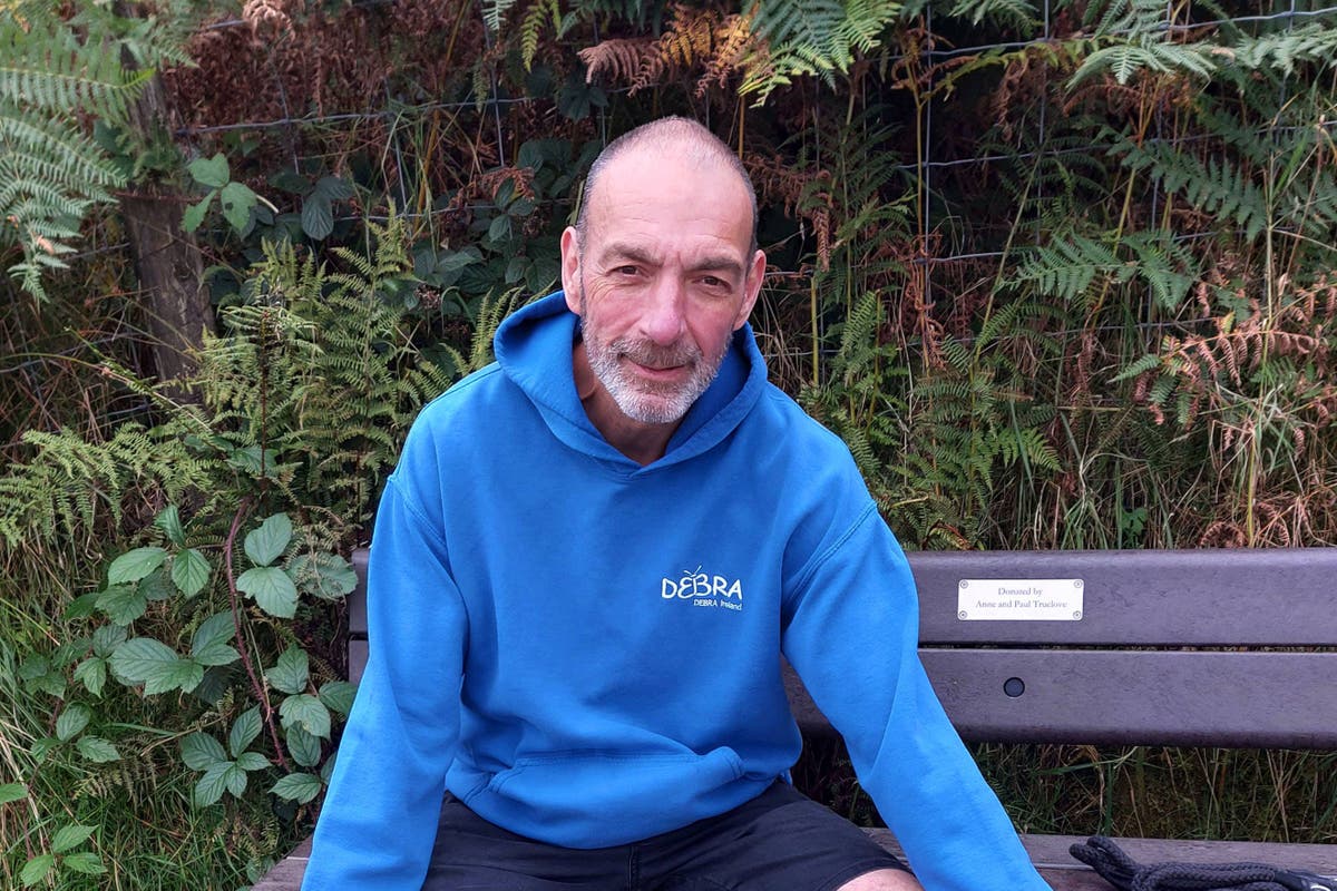 Cancer survivor trains for mountain trek in aid of ‘butterfly skin’ charity