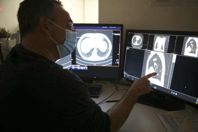 <p>Radiologist Fredric Pedulla shows a nodule on a lung scan of a smoking person for the Acapulco experimentation in Ajaccio on December 16, 2021 on the French Mediterranean island of Corsica</p>