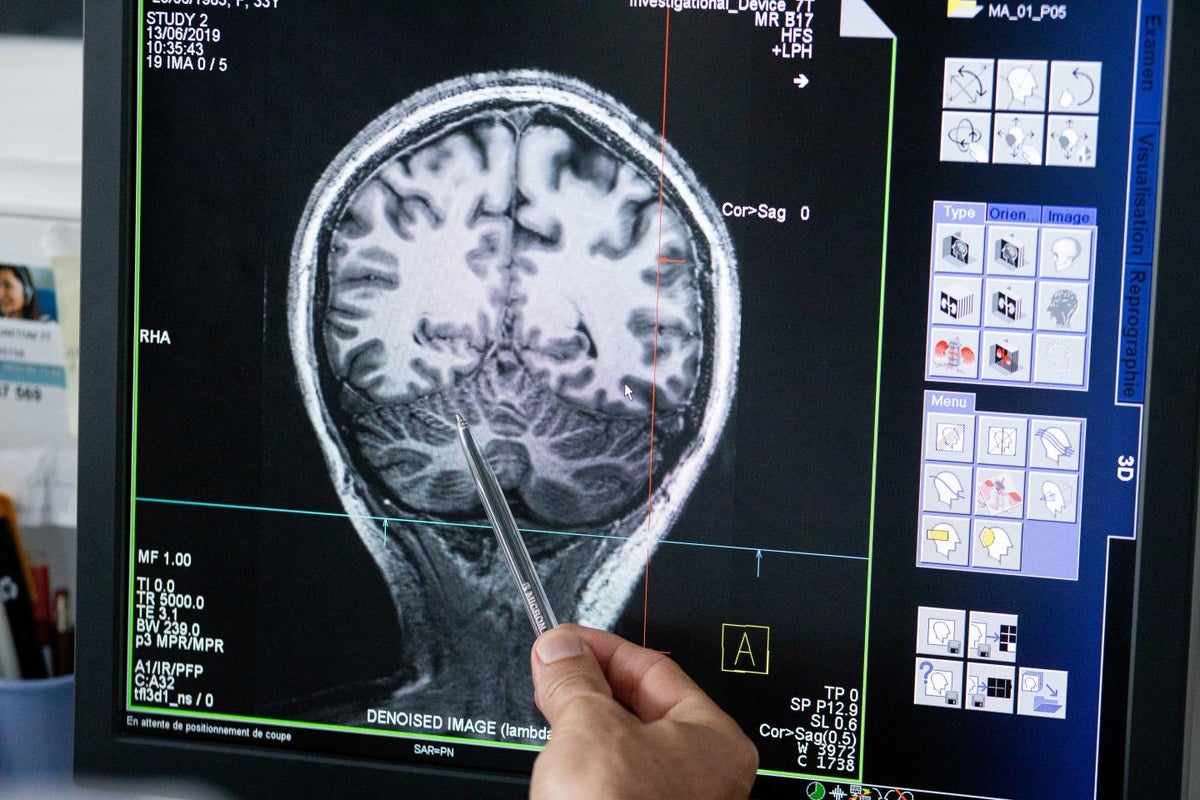 Coma patients may experience fleeting consciousness seconds before ...