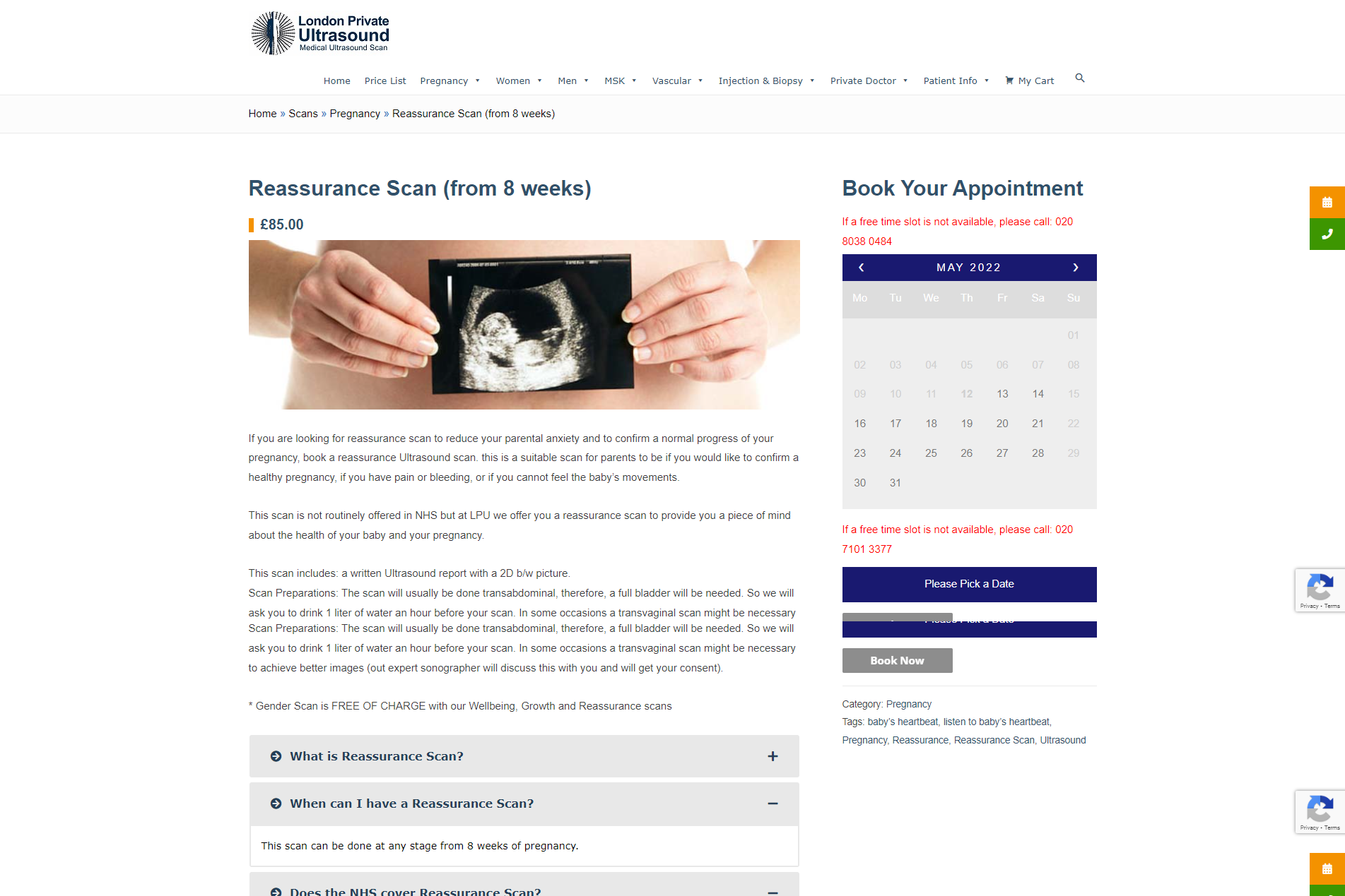 Adverts for ultrasound services have been banned for misrepresenting the extent to which the scans can provide reassurance about the wellbeing of an unborn baby (ASA/PA)