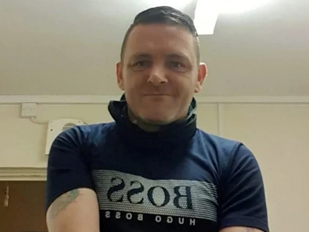 Patient scarred for life after botched operation left him with severe burns