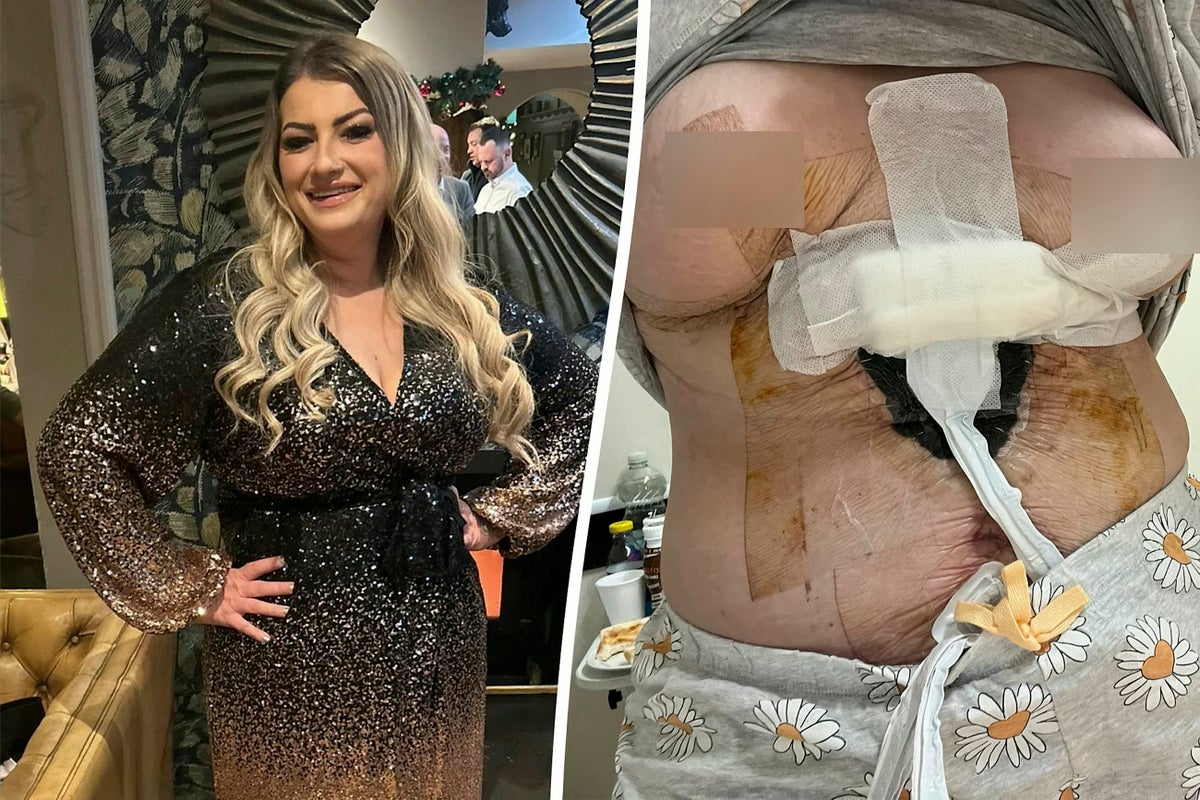 Woman claims surgeon ‘let her breast die’ on Turkey cosmetic trip
