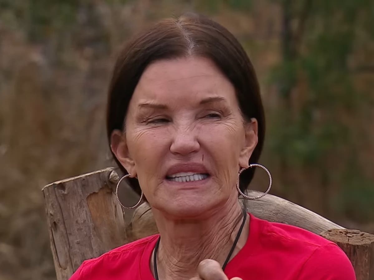 Janice Dickinson leaves I’m a Celebrity after on-set accident sends her to hospital