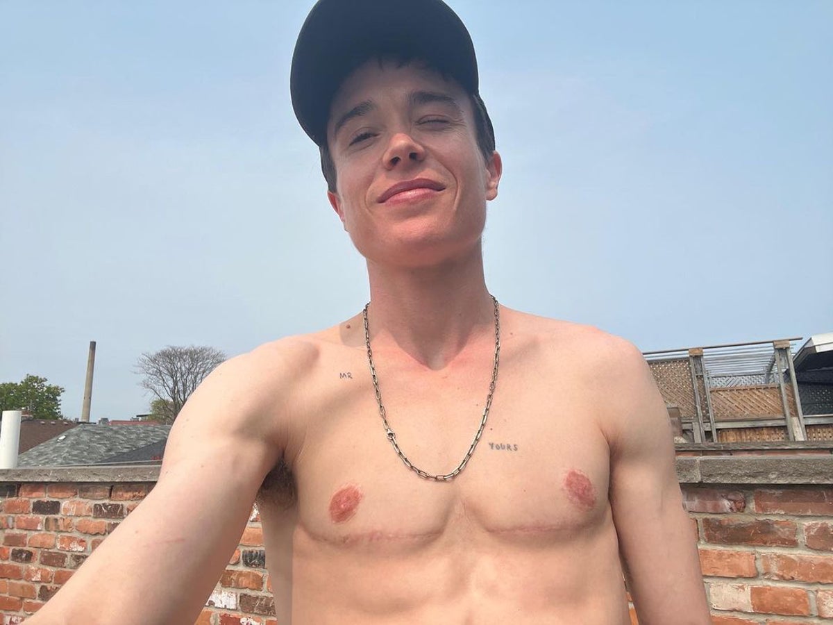 Elliot Page praised for discussing dysphoria as he shows chest scars in shirtless photo