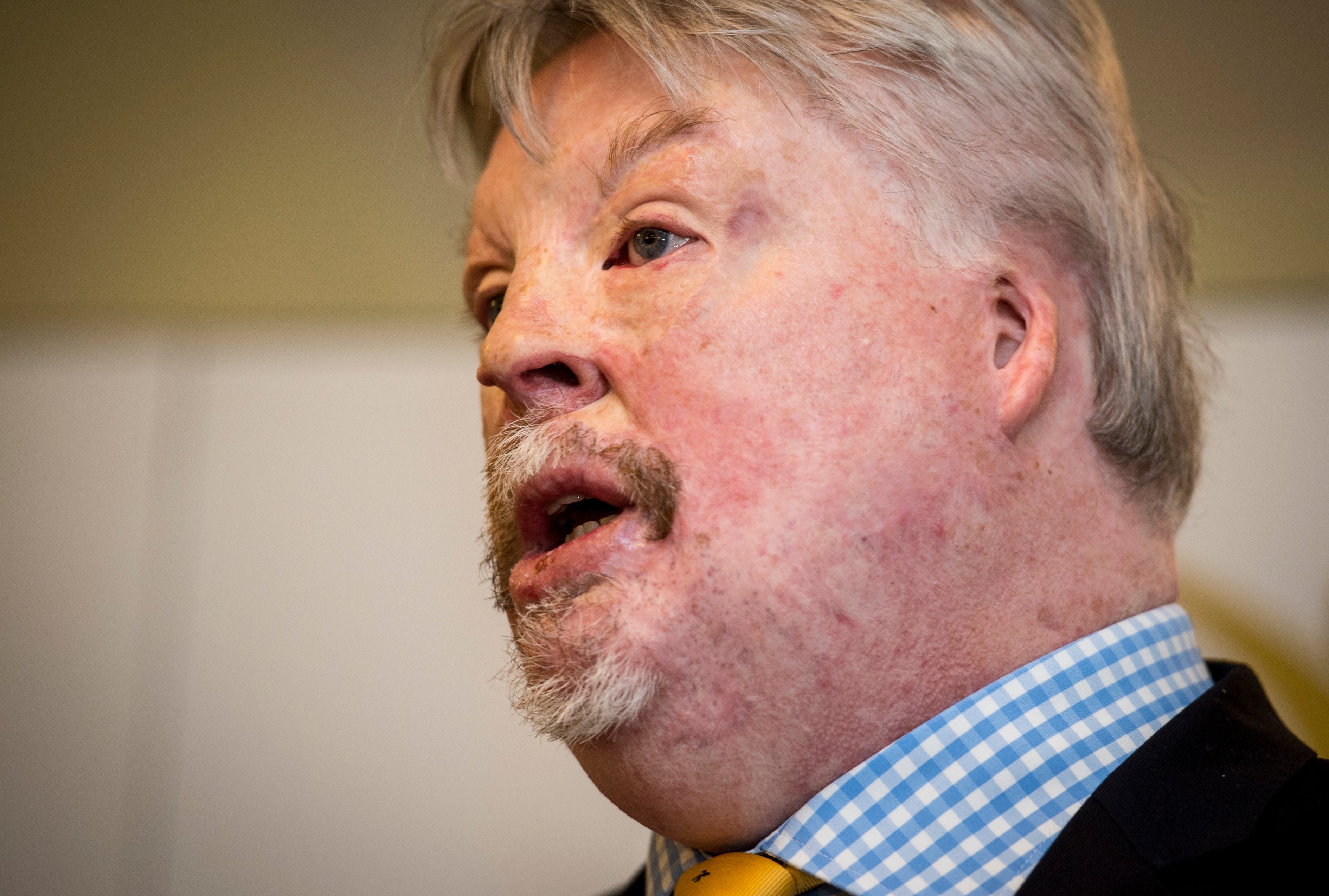 Simon Weston said the pilot had ‘shown courage, endeavour and ingenuity to get here’