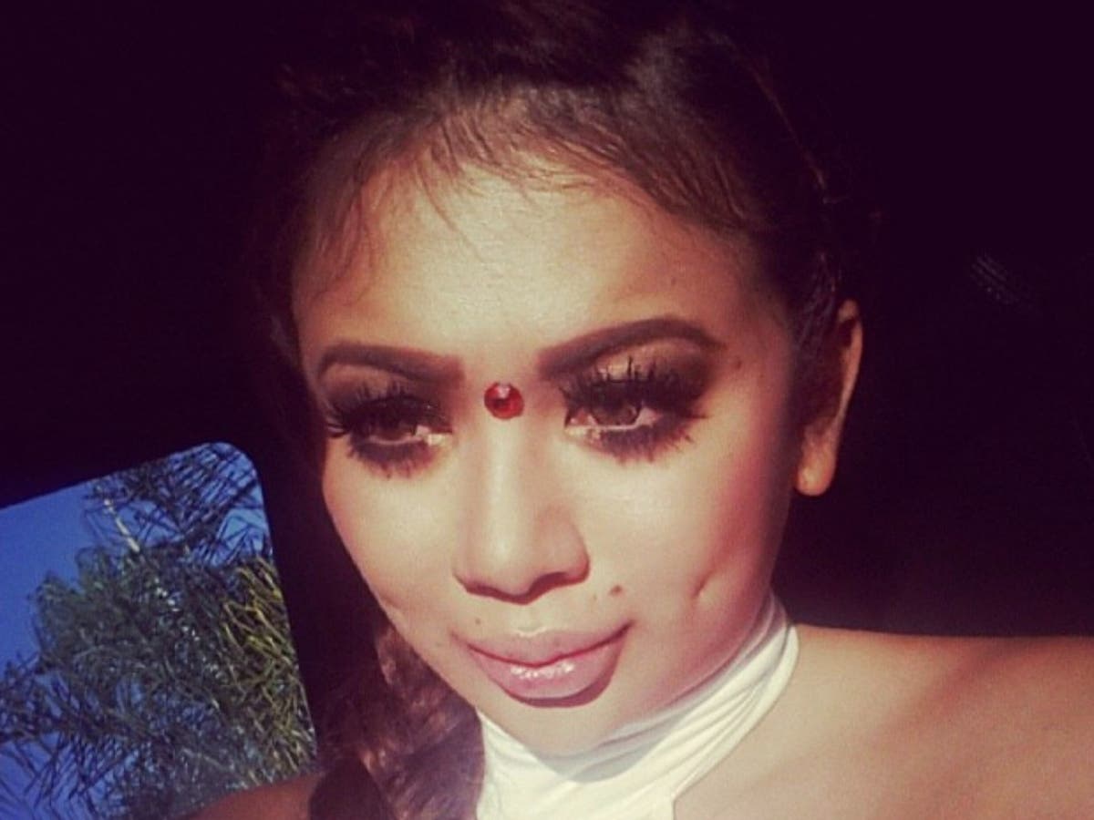 Woman spends $900 a month on cheek fillers after horrifying buccal fat removal: ‘I was in excruciating pain’ Woman spends $900 a month on cheek fillers after horrifying buccal fat removal: ‘I was in excruciating pain’