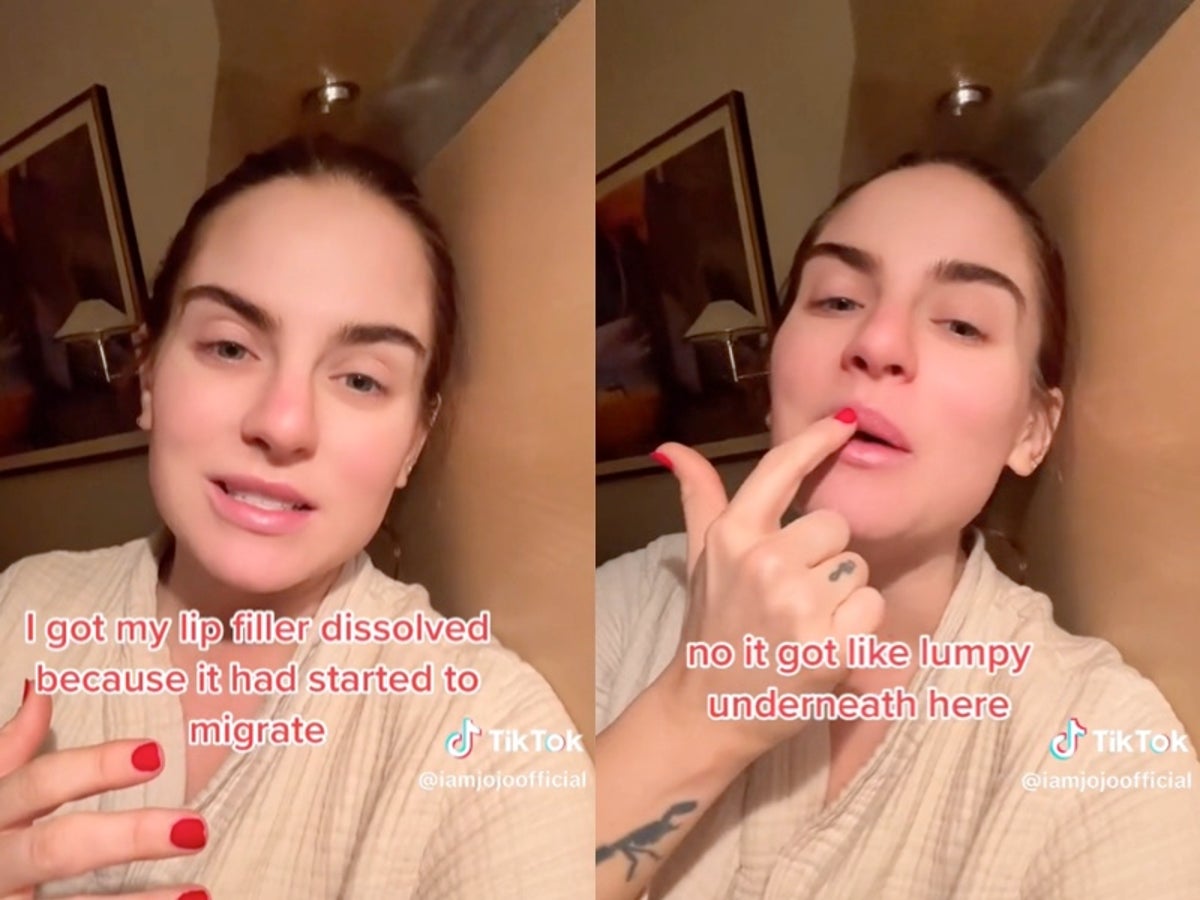 ‘I didn’t know it could do that’: JoJo reveals her alarm as lip filler started to ‘migrate’