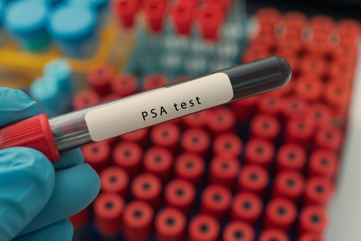 Seruan untuk meninggalkan pendekatan ‘tes berdasarkan permintaan’ dalam perawatan kanker prostat