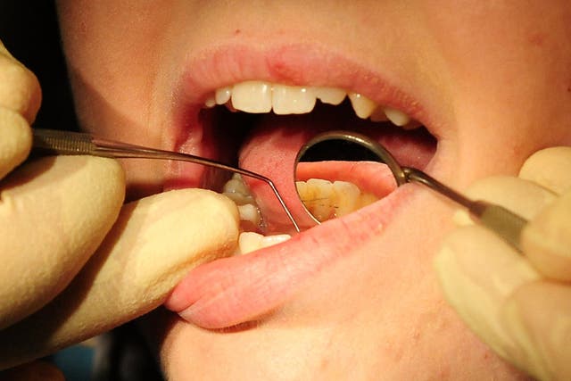 There has been a drop in the number of dentists working in the NHS in England, new figures suggest (Rui Vieira/PA)