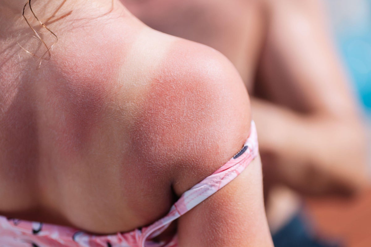 Bank holiday heatwaves predicted: 6 sunburn myths that could put you at risk