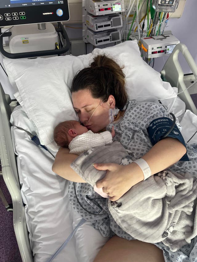 <p>Six days after 27-year-old Charleigh Chatterton, from Harwich, Essex, gave birth to her daughter Alessia without any complications, she developed flu-like symptoms and a small rash on her stomach</p>