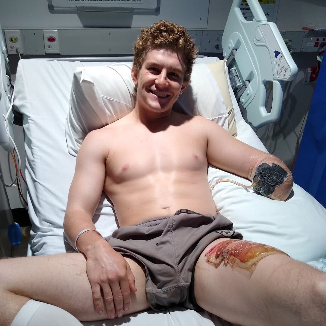 Henry Dunn is still recovering after losing an arm in an accident on a farm in Australia
